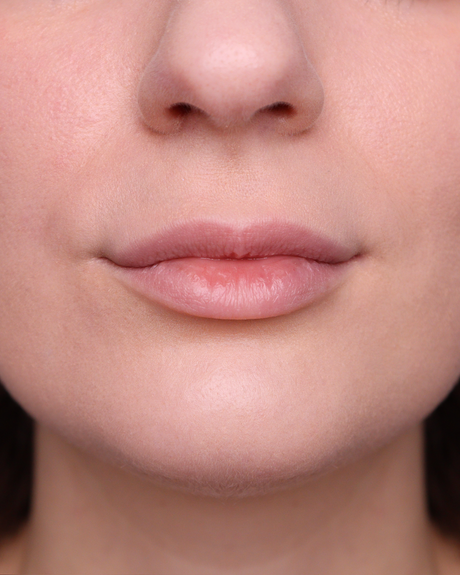 Collagen More Gloss Volumizzante 02 Peony