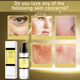 Advanced Snail 96 Mucin Power Essence Essenza Viso alla Mucina di Lumaca